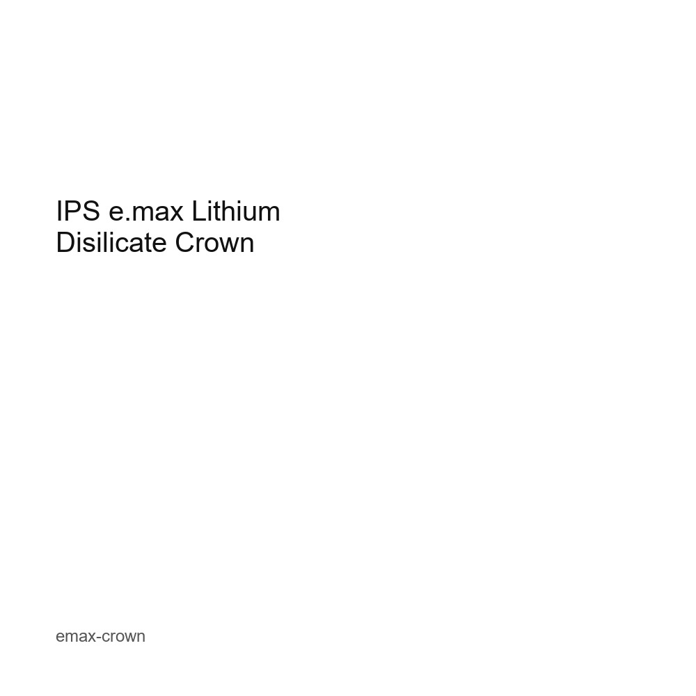 IPS e.max Lithium Disilicate Crown